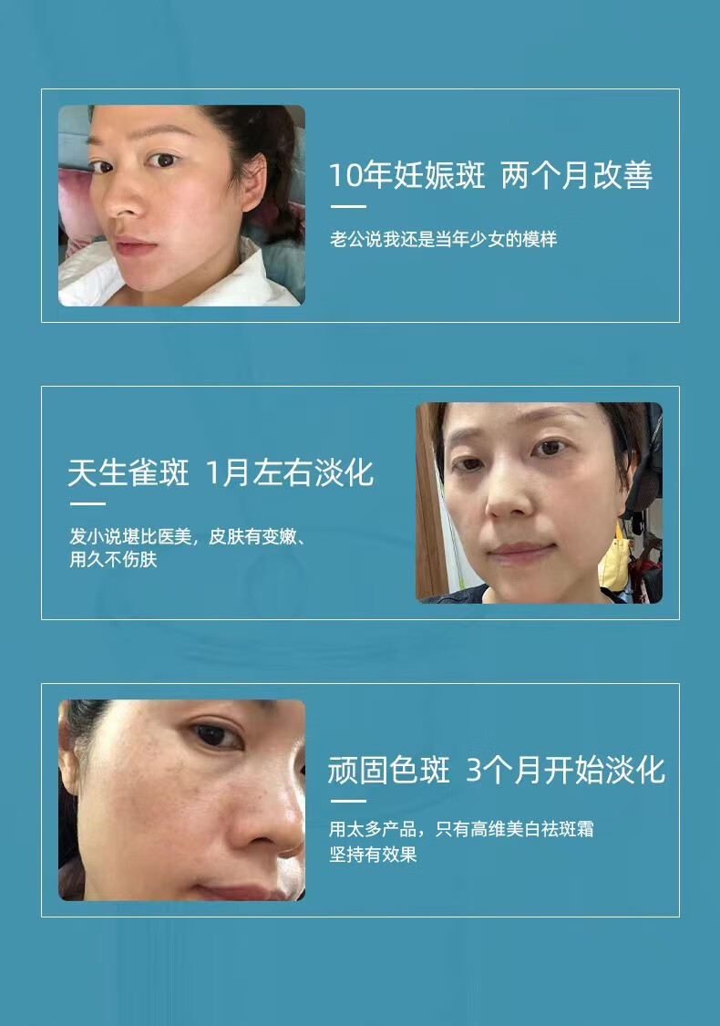 花恩诗美白祛斑霜 雀斑妊娠斑老斑黄褐年斑祛斑保湿补水护肤素颜面霜 二盒【轻度祛斑】