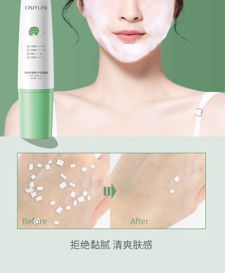 欧丝韵微酸积雪草小气泡面膜100g自发泡清洁毛孔控油肌肤补水 【表层清洁】1支装100g
