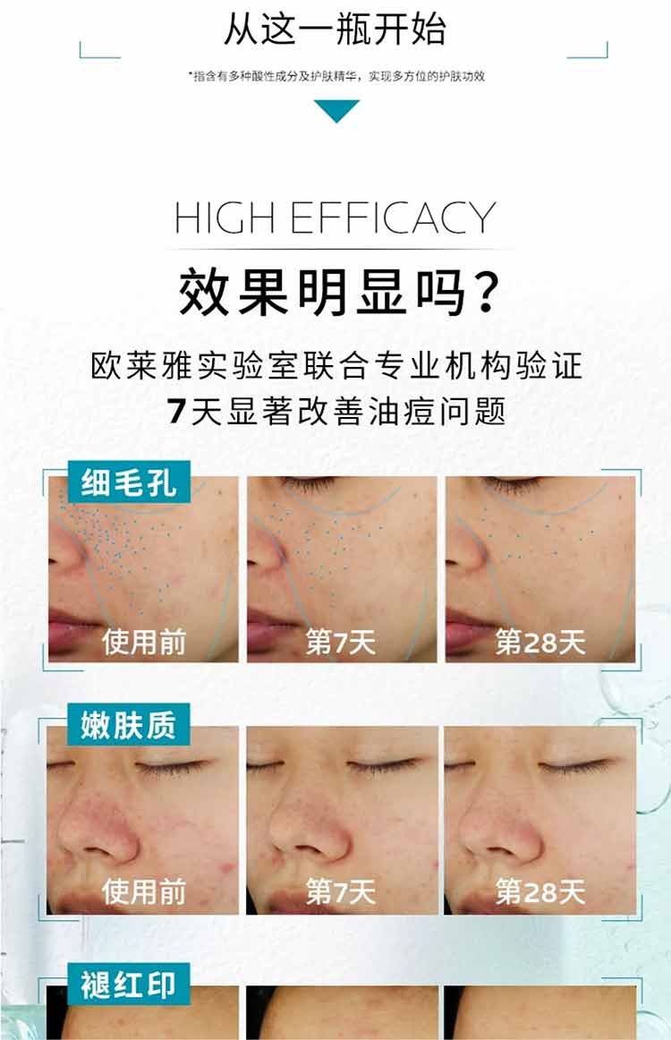 理肤泉理肤泉水杨酸淡化痘痕祛痘黑头粉刺三酸焕肤精华液30ml 三酸精华30ml*双支