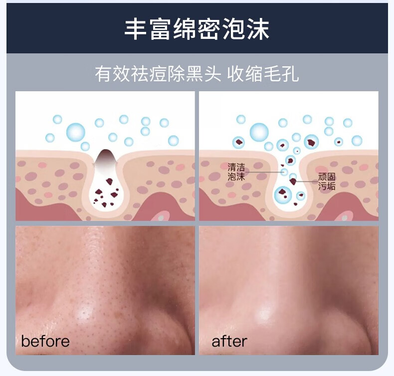 IDX男士控油洗面奶收缩毛孔深层清洁保湿不紧绷抗痘去黑头除螨洁面乳 120g