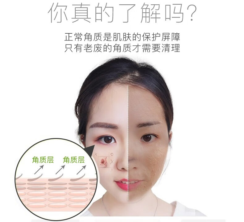 碧雅漫柠檬搓角质啫喱洗面奶温和清洁毛孔脸部男女士通用 搓角质啫喱100gX1盒