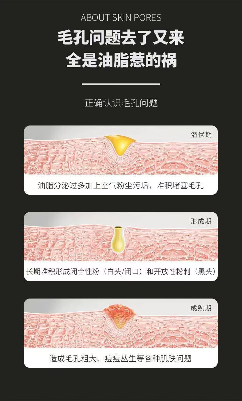 慕霖兮去黑头清洁绿茶面膜套装撕拉式鼻膜贴细致毛孔去粉刺深层清洁泥膜 绿茶面膜*一盒（赠送工具）