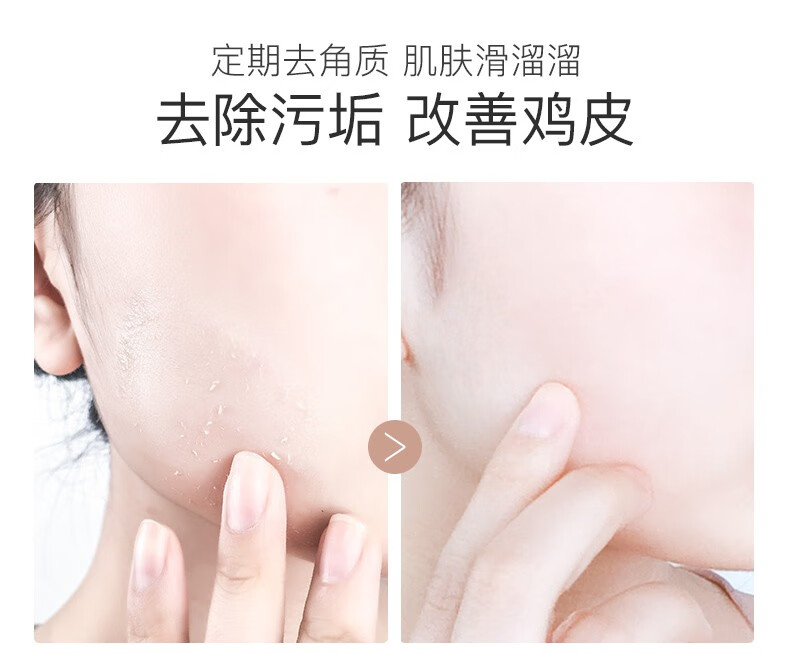碧雅漫柠檬搓角质啫喱洗面奶温和清洁毛孔脸部男女士通用 搓角质啫喱100gX1盒