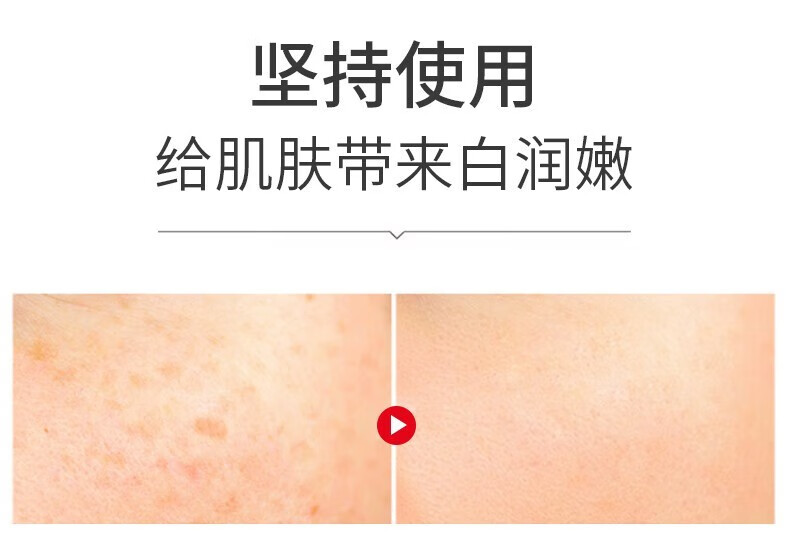 人仁和匠心修护美白祛斑霜 淡化斑烟酰胺精华膏提亮肤色保湿素颜熬夜 祛斑套装