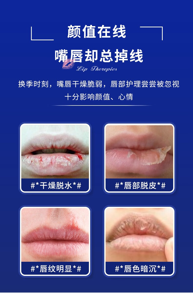 仁和 滋润护唇膏男女保湿唇膜深层滋润唇纹淡化防干裂 四种口味