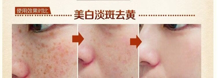 韩泊莉笑影冬虫夏草二合一美白祛斑霜套装淡斑保湿黄褐斑雀斑化妆品 日霜+日霜