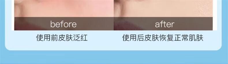 瑞倪维儿（Rinawale）透明质酸凝胶60g康婷面部护肤品芦荟胶修护补水保湿滋养舒缓肌肤 1支装