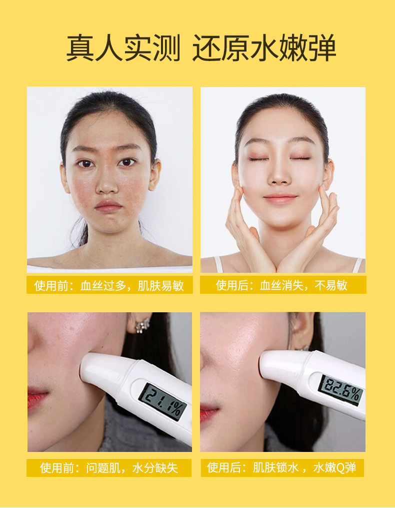 迪迈诗童颜黄油面膜深度补水保湿修补皮脂膜滋养控油 10片装/盒