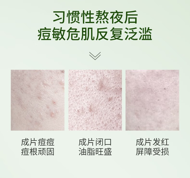 孔凤春马齿苋净痘精华液祛痘祛闭口粉刺呵护加速催熟瘪痘男女学生通用 30ml