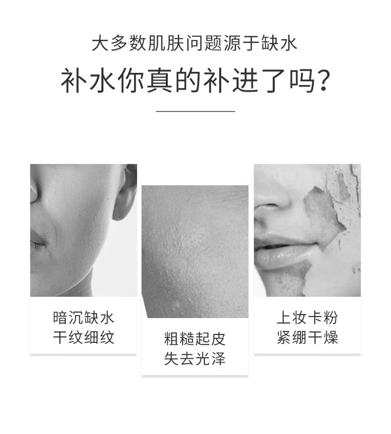 AHC爽肤水男大绿水大瓶湿敷水女补水闭口粉刺痘痘缩毛孔深度清爽控油 300ml（一瓶）
