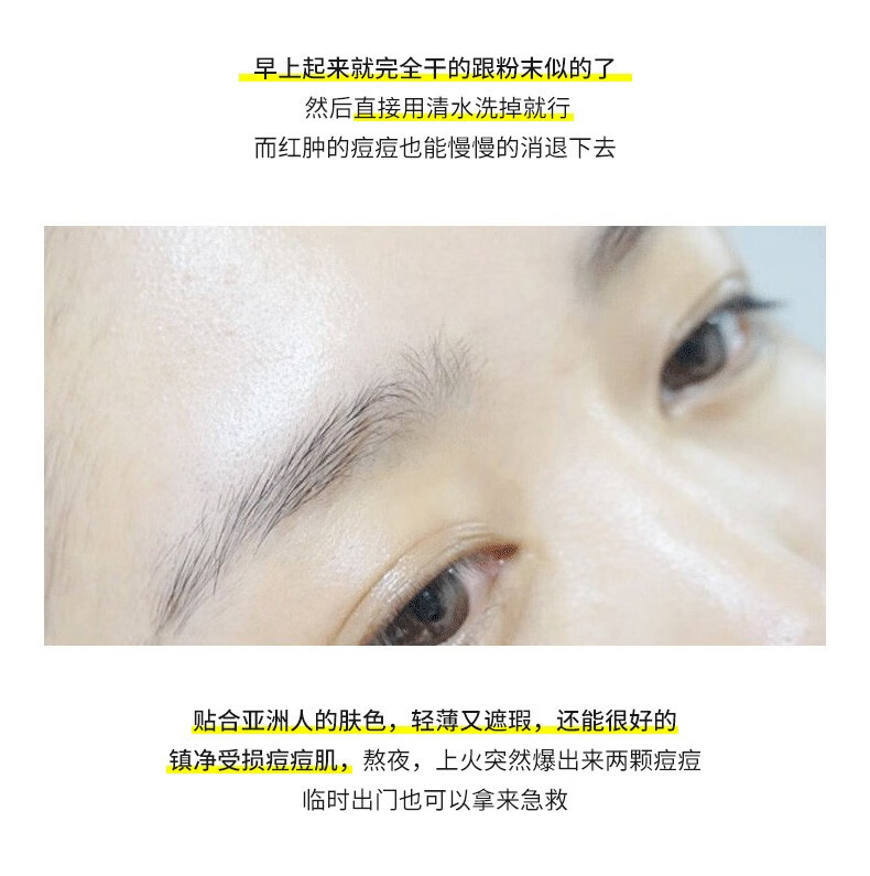 肌肤之食（skinmenu） 祛痘精华液10ml 紧急祛痘原液淡化痘印熬夜油痘收缩毛孔男女学生青春痘 【净颜祛痘】2瓶祛痘粉水+嫩白精华