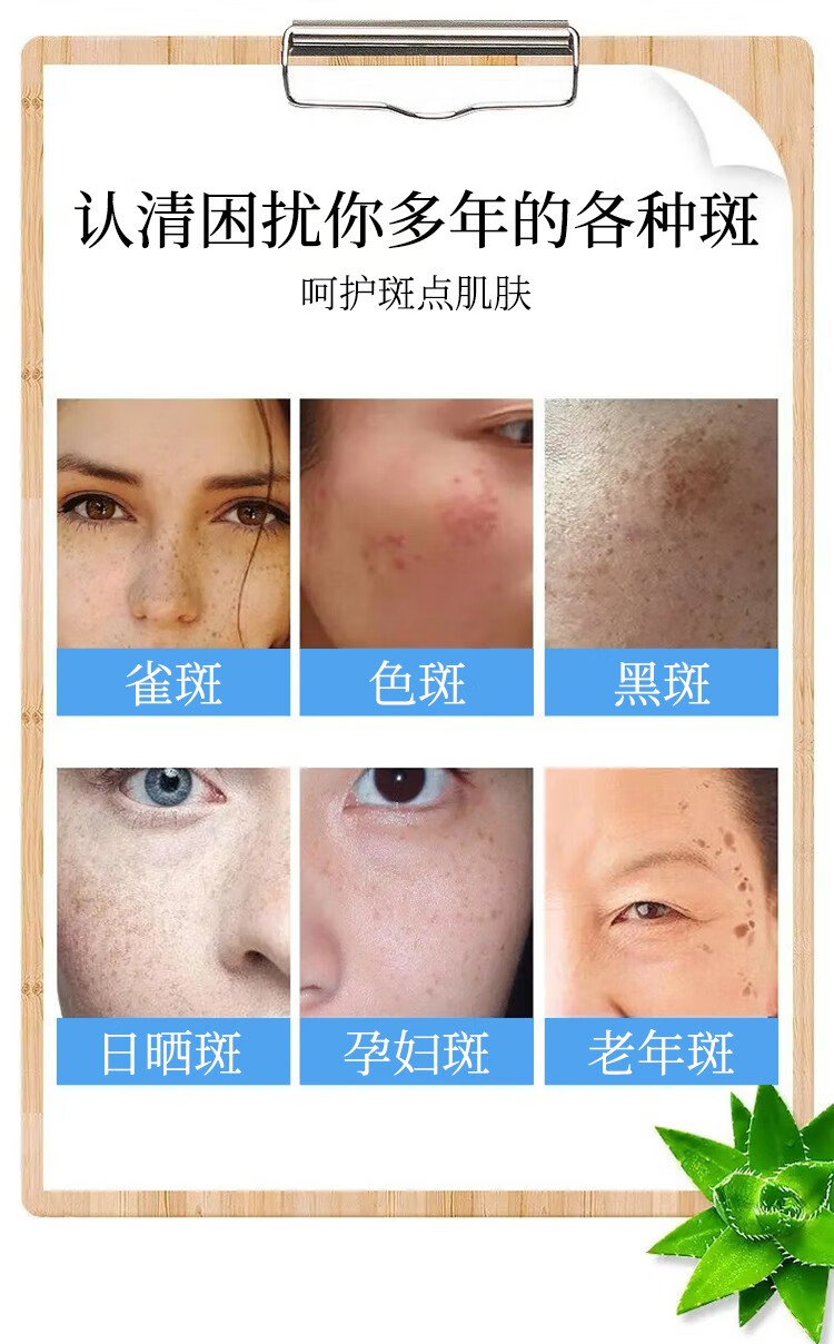 咔诗迪曼白白日记美白祛斑霜去斑霜淡斑霜黄褐斑雀斑老年斑孕斑美白护肤品 美白祛斑霜八盒