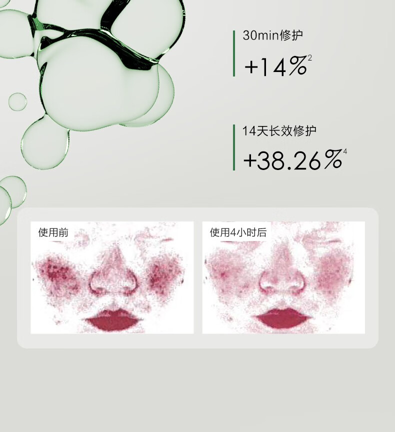 一叶子（One leaf）护肤品水乳套装补水保湿B5舒缓修护敏感肌改善泛红男女新年礼物 B5修护保湿3件套：洗面奶+水+乳