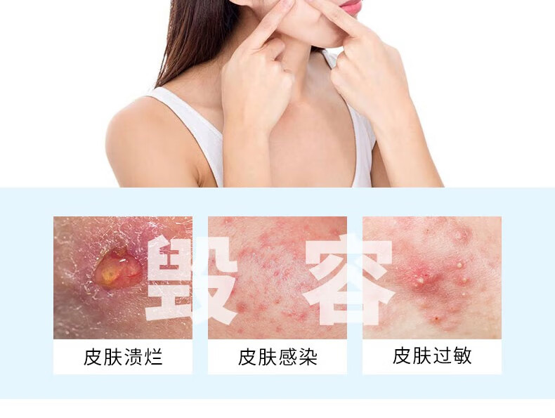 珂莱藻堂细胞夹斜嘴粉刺针套装去黑头针暗疮针挤痘工具美容院镊子套盒 粉刺针5件套