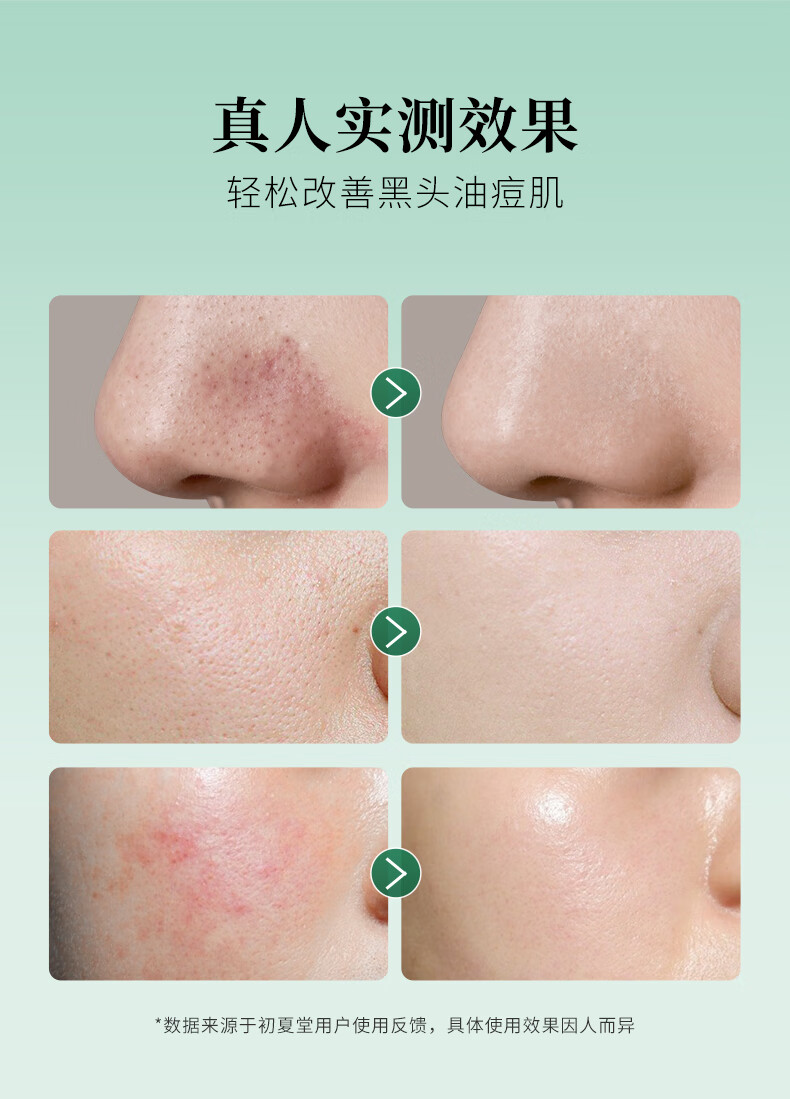 初夏堂黑冻膜120g深层清洁控油毛孔黑头白头粉刺痘印涂抹式去面膜泥男女