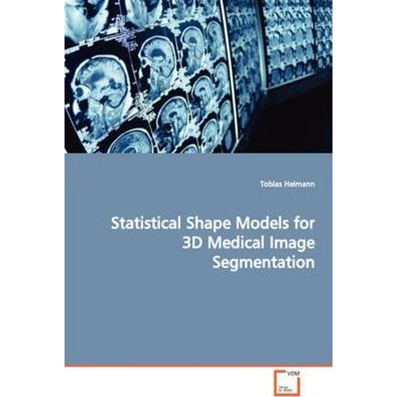 按需印刷Statistical Shape Models for 3D Medical Image Segmentation[9783639050561]