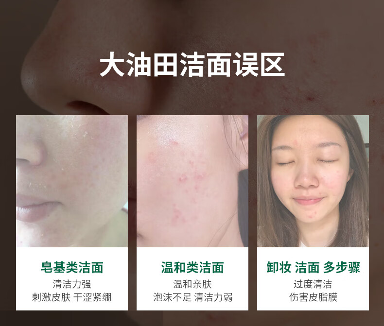 星期四茶树（Thursday Plantation）星期四农庄氨基酸洗面奶控痘男士控油洗面奶女去油卸妆 洁面泡沫 150ml