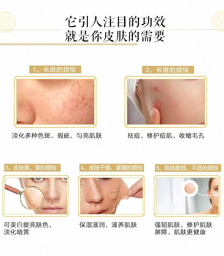 片仔癀 皇后牌珍珠霜 国货护肤品祛痘美白保湿祛黄斑淡印修护面霜小瓷瓶 皇后款珍珠霜20g*3瓶