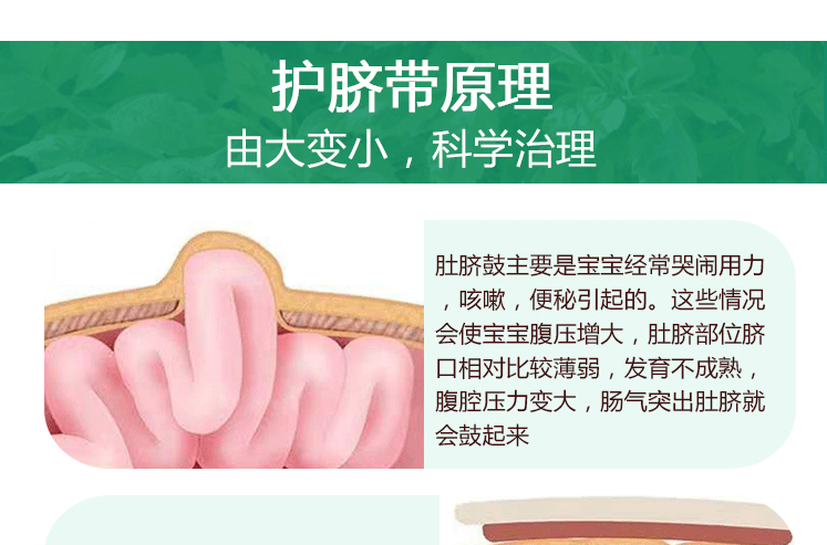新生婴幼儿凸肚脐护脐带宝宝压肚脐鼓突出绑腹带气肚脐围贴透气疝超值