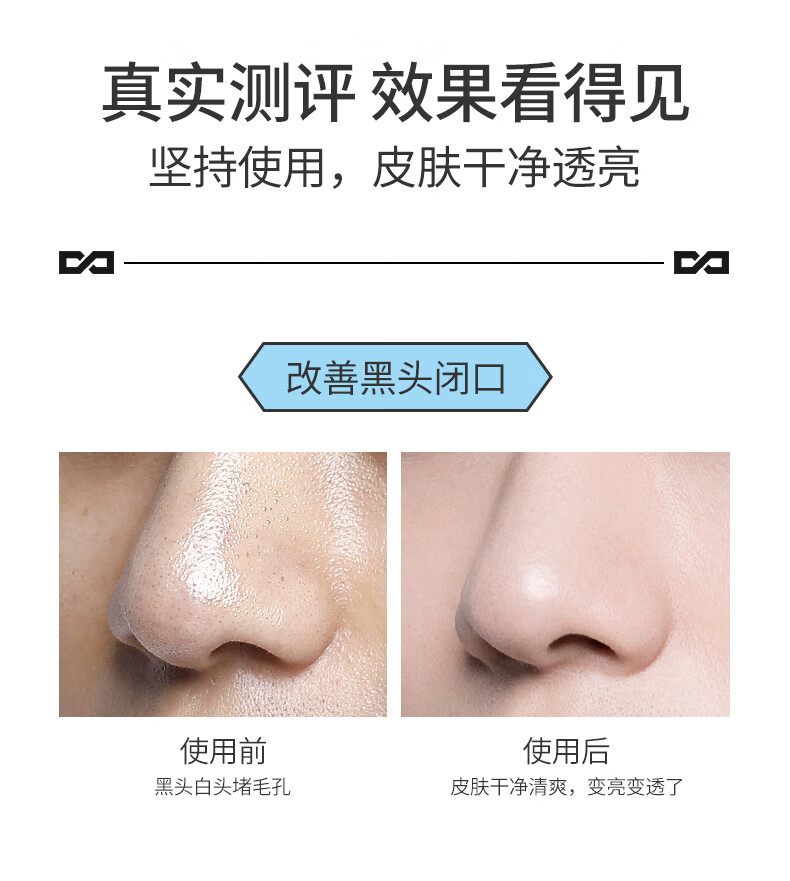 左颜右色 茶树精油清洁泥膜面膜去黑头粉刺闭口 控油补水修护毛孔收缩涂抹式面膜男士护肤 茶树泥膜+毛孔收缩精华