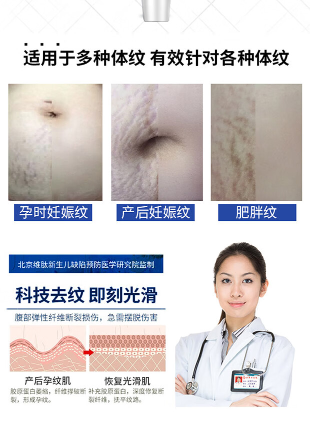 妊娠纹祛去除修复霜预防孕妇专用护理产后消除紧致妊辰纹霜淡化油