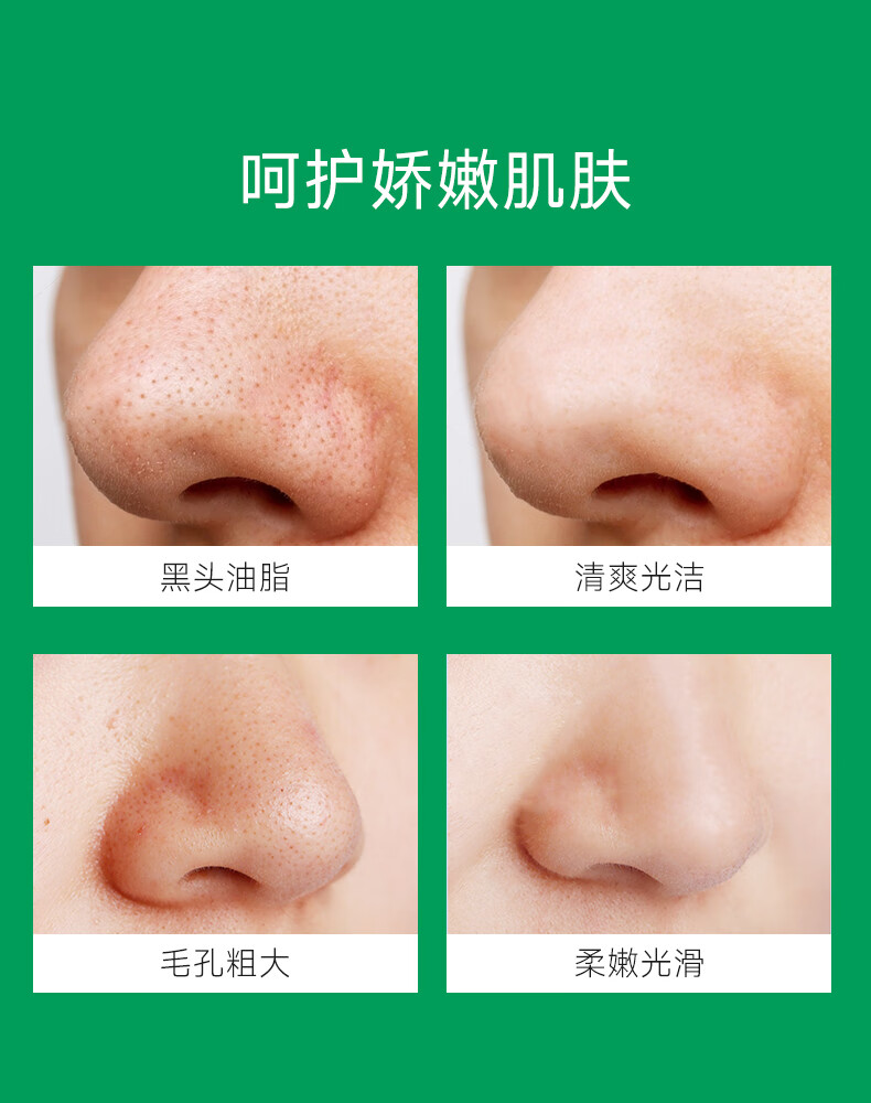 CCA去黑头套盒鼻贴5组10片导出精华液吸粉刺面膜贴收缩毛孔不撕拉温和男女 COCOAMELIA CCA去黑头鼻贴【免撕拉