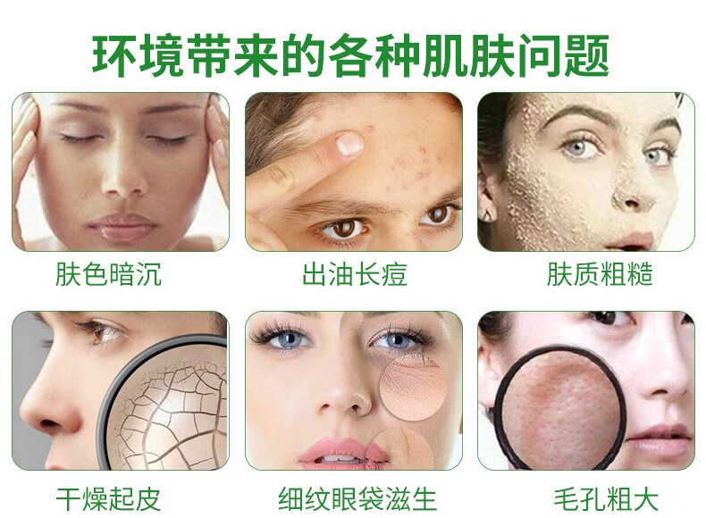 仁和 芦荟胶补水晒后补水保湿舒缓肌肤提亮肤色啫喱面霜 护肤品300g 芦荟胶1盒