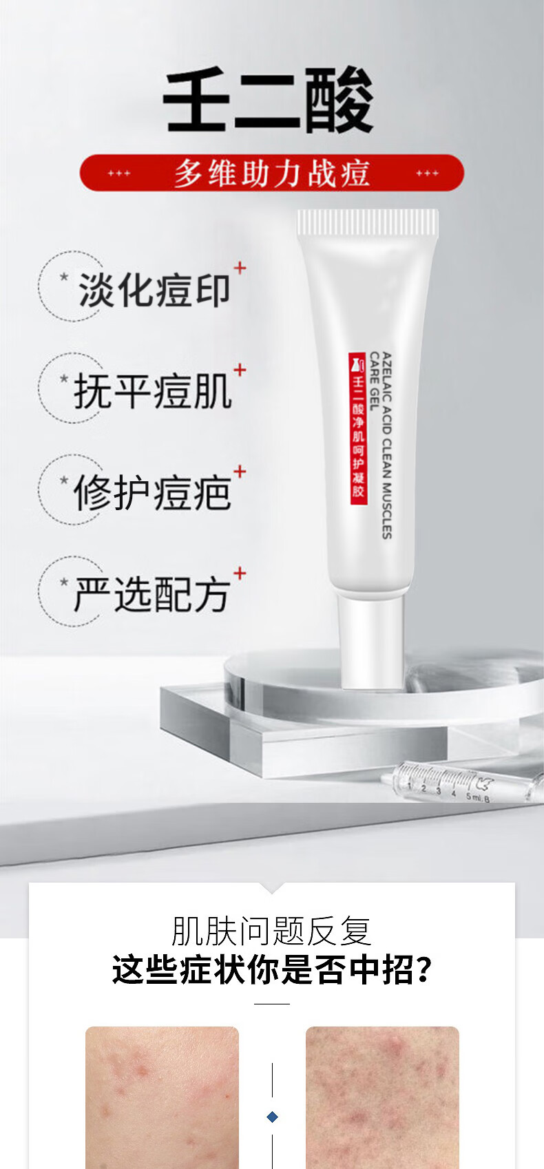 翼颜壬二酸凝胶15%软膏祛痘精华凝露水杨酸唑去淡化黑头粉刺痘印乳膏 壬二酸修护凝胶2盒