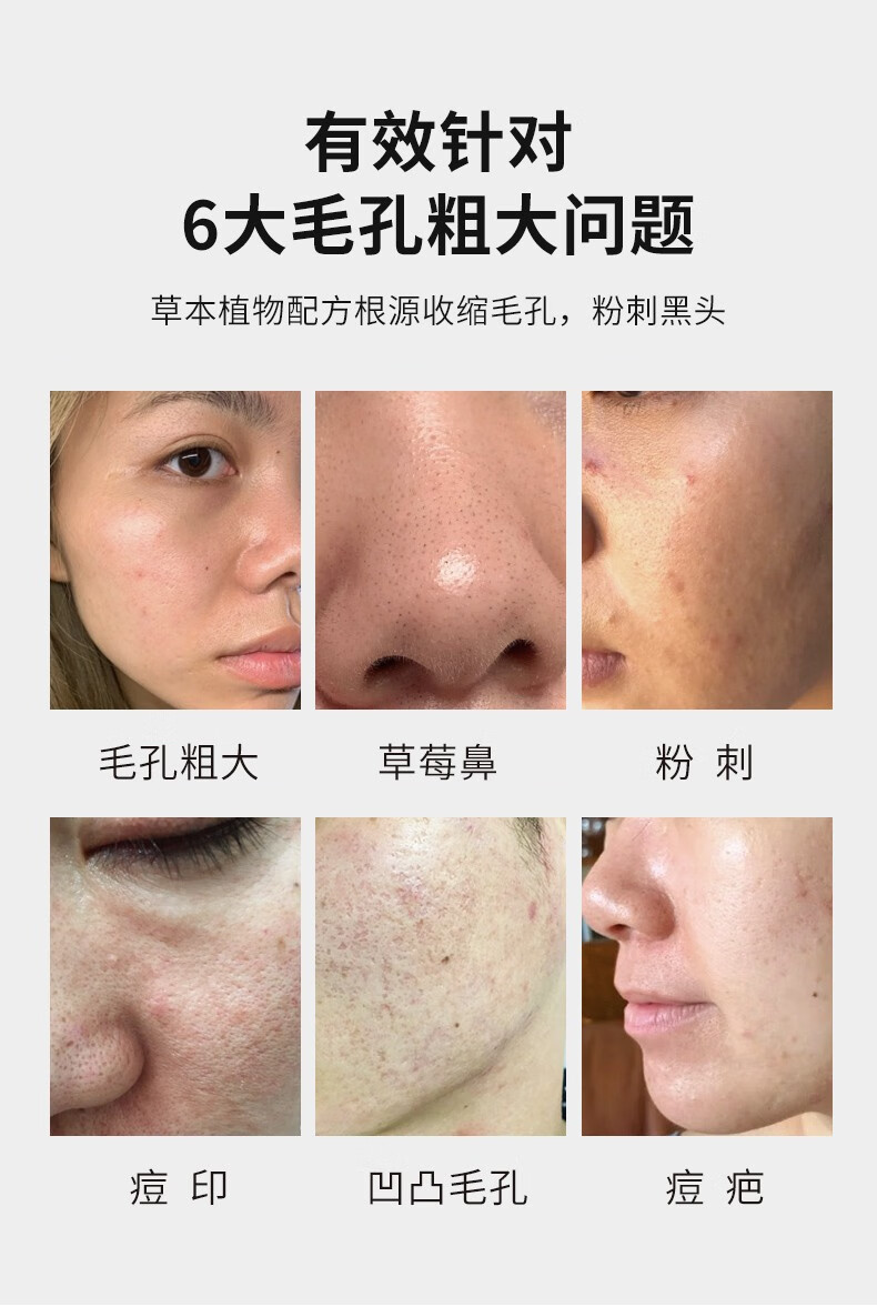 人 仁和匠心收缩毛孔精华液原液细致毛孔粗大脸部保湿补水男女通用 100ml*3瓶