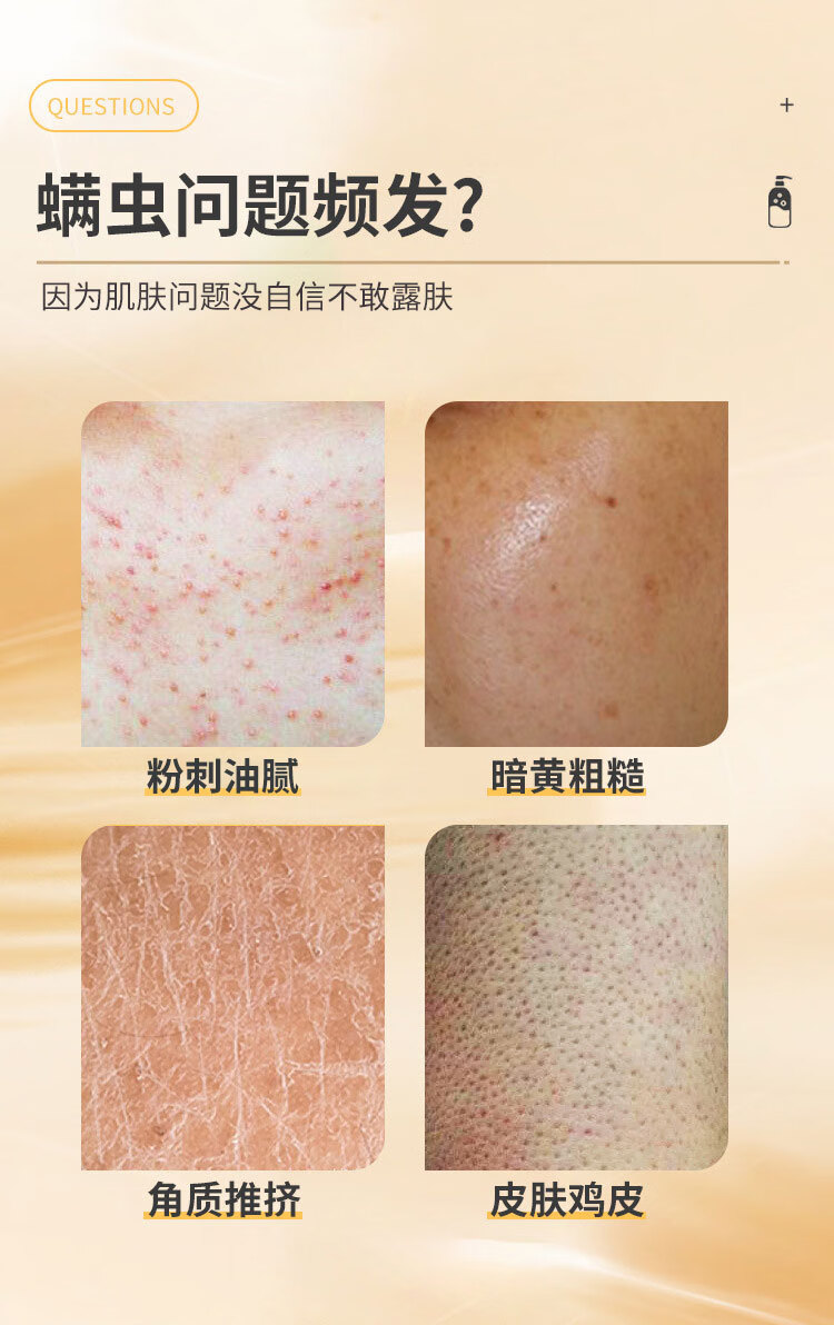 硫磺除螨沐浴露螨虫后背痘痘祛控油去多效沐浴皂液露滋润硫磺液体香皂男女 硫磺沐浴露x2瓶