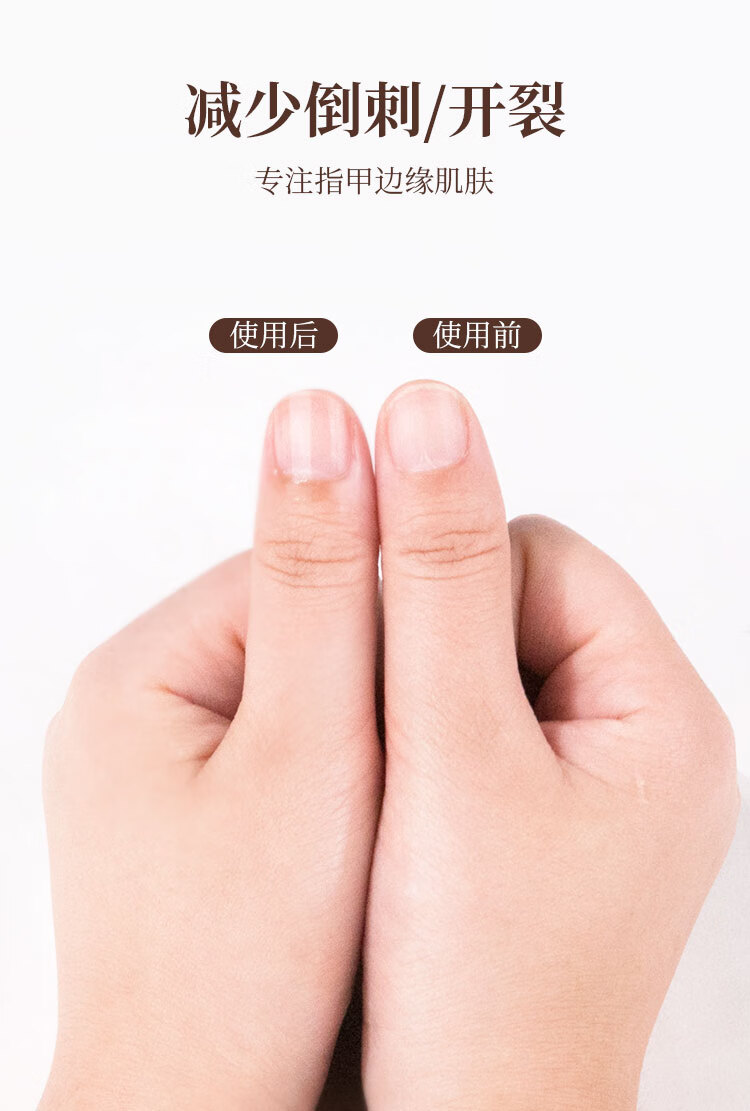 指甲营养油笔修护美甲指缘护甲油营养笔边缘滋养防倒刺美甲指缘油精华牛油果男女学生 1支5mL