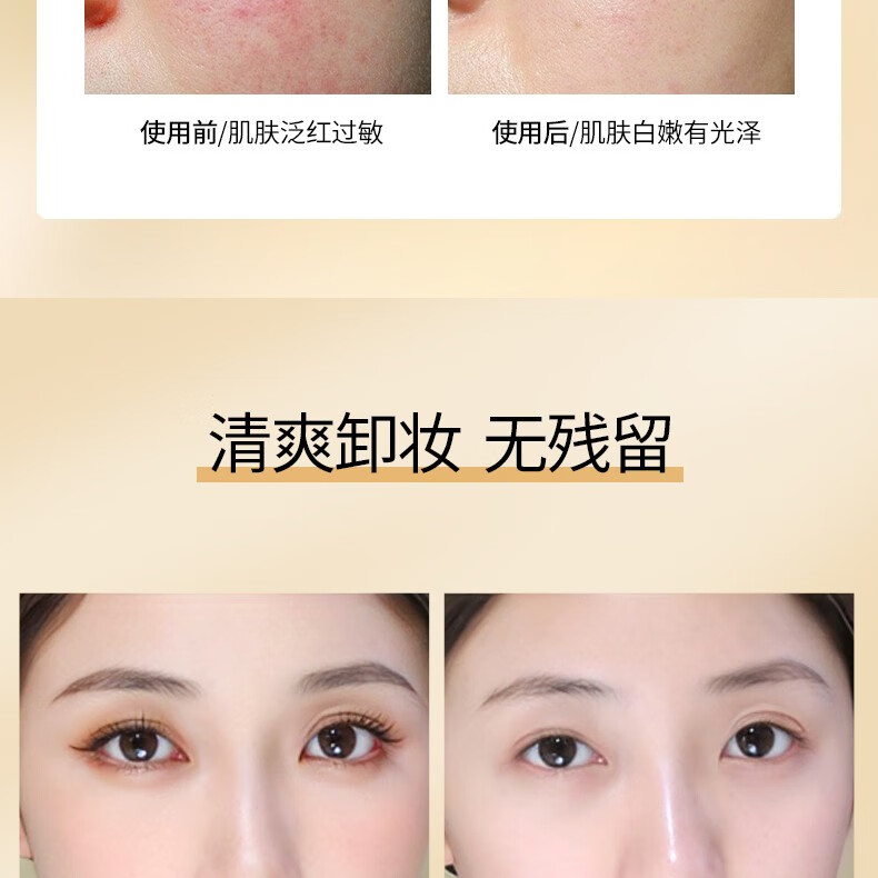 TREECHADA泰国TR进口椰子卸妆油眼唇脸三合一深层清洁毛孔温和敏感肌 1瓶：椰子卸妆油