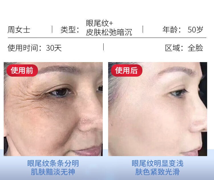 人仁和匠心 六胜肽抗皱面霜抗皱紧致保湿补水保湿护肤淡化法令纹额头纹 抗皱面霜50g