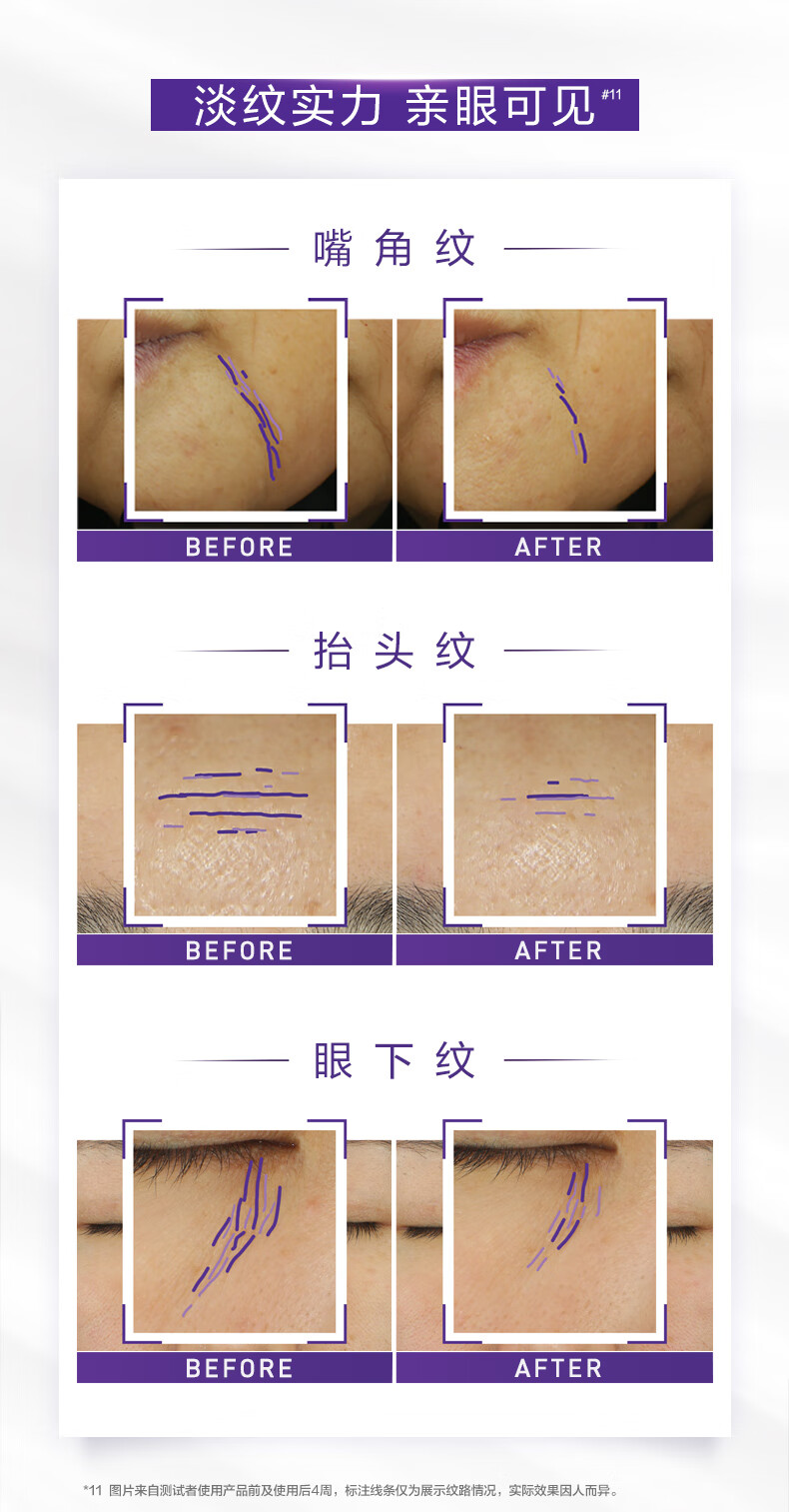 焱蜀（精选好物）第二代紫熨斗眼霜玻色因全脸提拉眼周 弹润柔滑