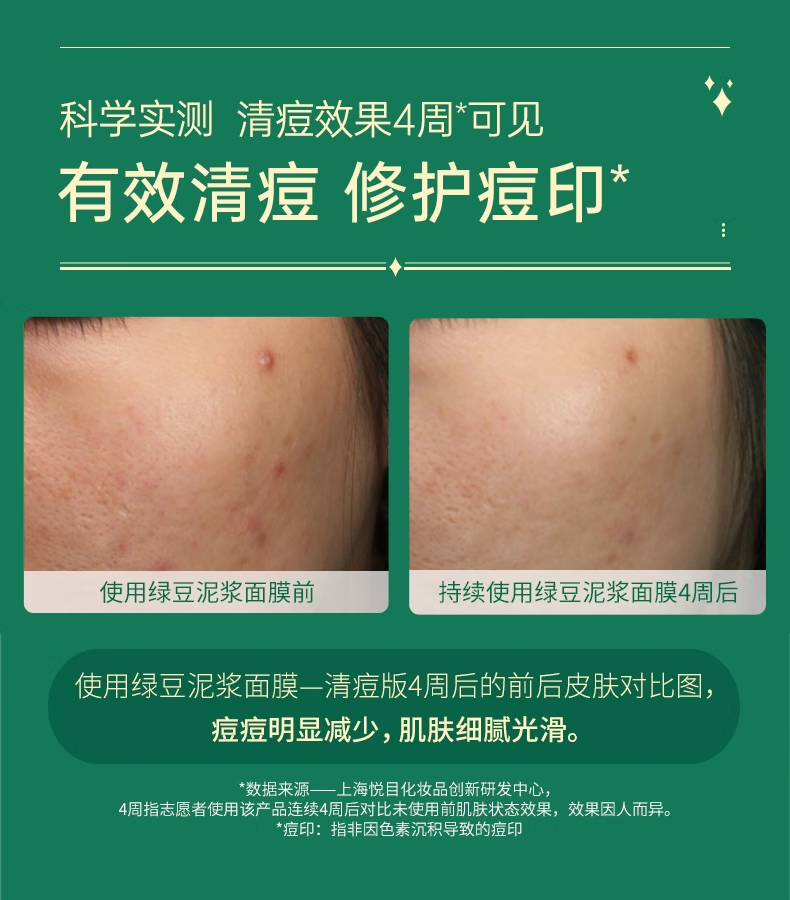 膜法世家绿豆清洁泥膜改善黑头闭口深层清洁毛孔美白面膜祛痘控油魔法世家 珍珠粉泥膜135g