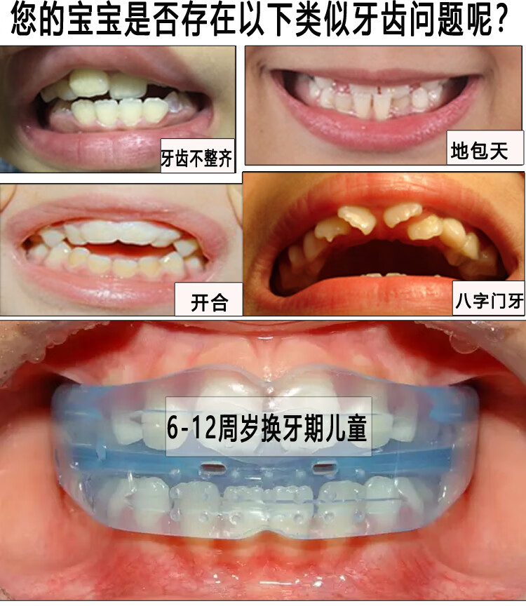 夜间门牙突出龅牙纠正器小孩地包天矫正牙套 盒子 (8-12周岁) 儿童c1