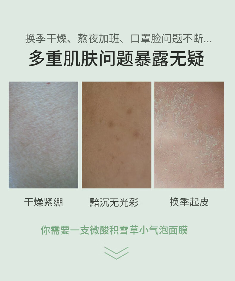 欧丝韵微酸积雪草小气泡面膜100g自发泡清洁毛孔控油肌肤补水 【表层清洁】1支装100g