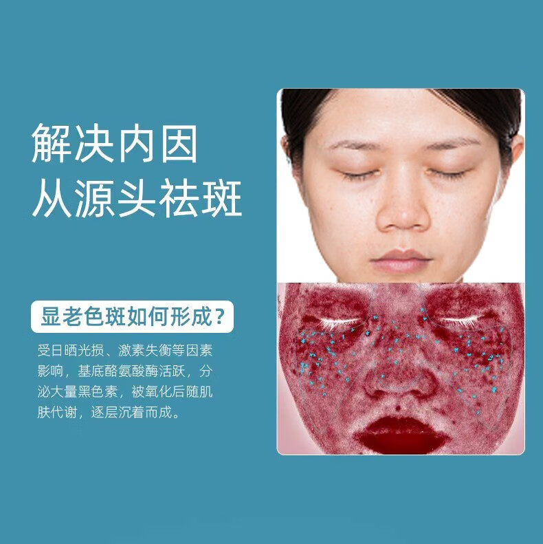 花恩诗美白祛斑霜 雀斑妊娠斑老斑黄褐年斑祛斑保湿补水护肤素颜面霜 二盒【轻度祛斑】