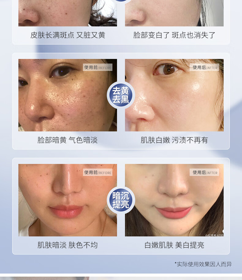 仁和药业 美白祛斑补水面膜 淡斑祛黄提亮保湿补水晒后美白面膜 男女士祛斑产品亮肤面膜 20片/盒