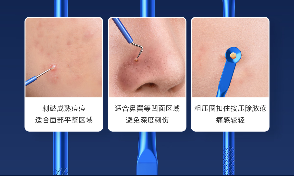 欧亿姿粉刺针套装细胞夹套装镊子祛黑头针粉刺痘痘超尖不锈钢美容院专用 尖嘴夹【单支套盒装】 #51
