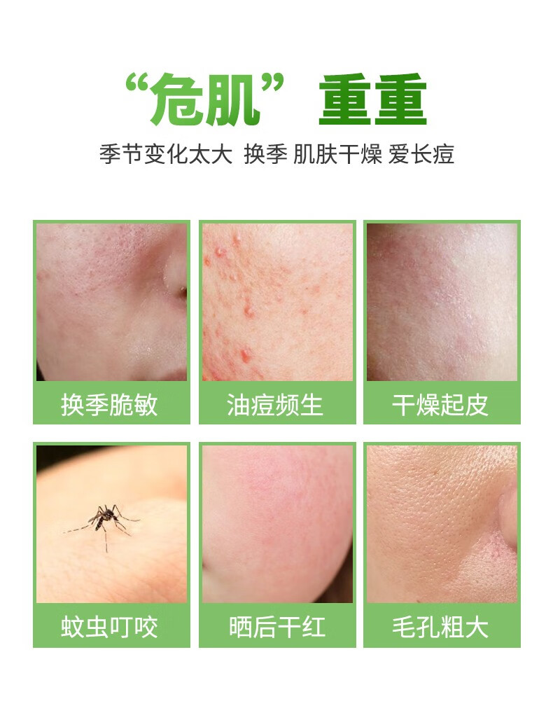 碧素堂库拉索芦荟胶300g补水保湿熬夜晒后护肤面霜大瓶装男女士学生可用 芦荟胶大容量300g