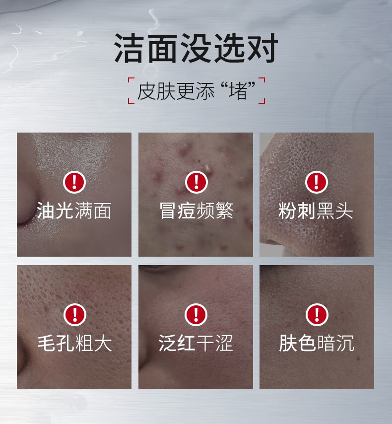 ning洗面奶氨基酸洁面乳控油祛痘除螨祛黑头深层清洁收毛孔男女通用 【温和清肤】洗面奶100g