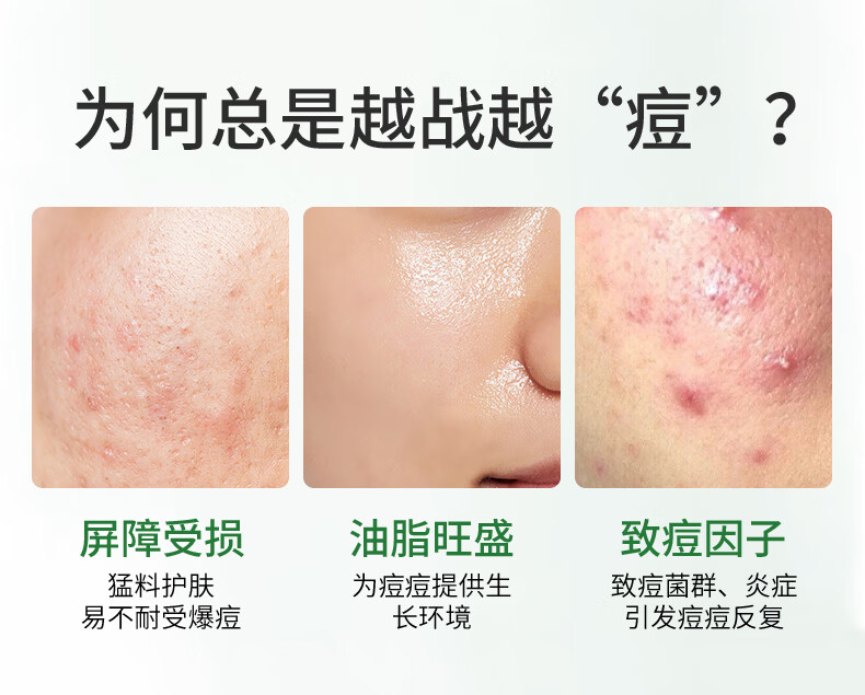 NACO层孔菌控油祛痘精华液次拋混油皮敏肌收缩毛孔肌肤舒缓淡化祛痘印 1盒30支+5支（1.2ML）