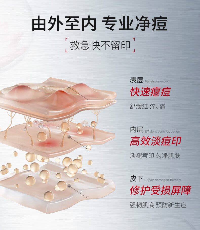 ning新加坡进口祛痘印修复淡化痘印痘坑收缩毛孔修复芦荟凝胶护肤品 【养成无痘肌】祛痘凝露50g*2支