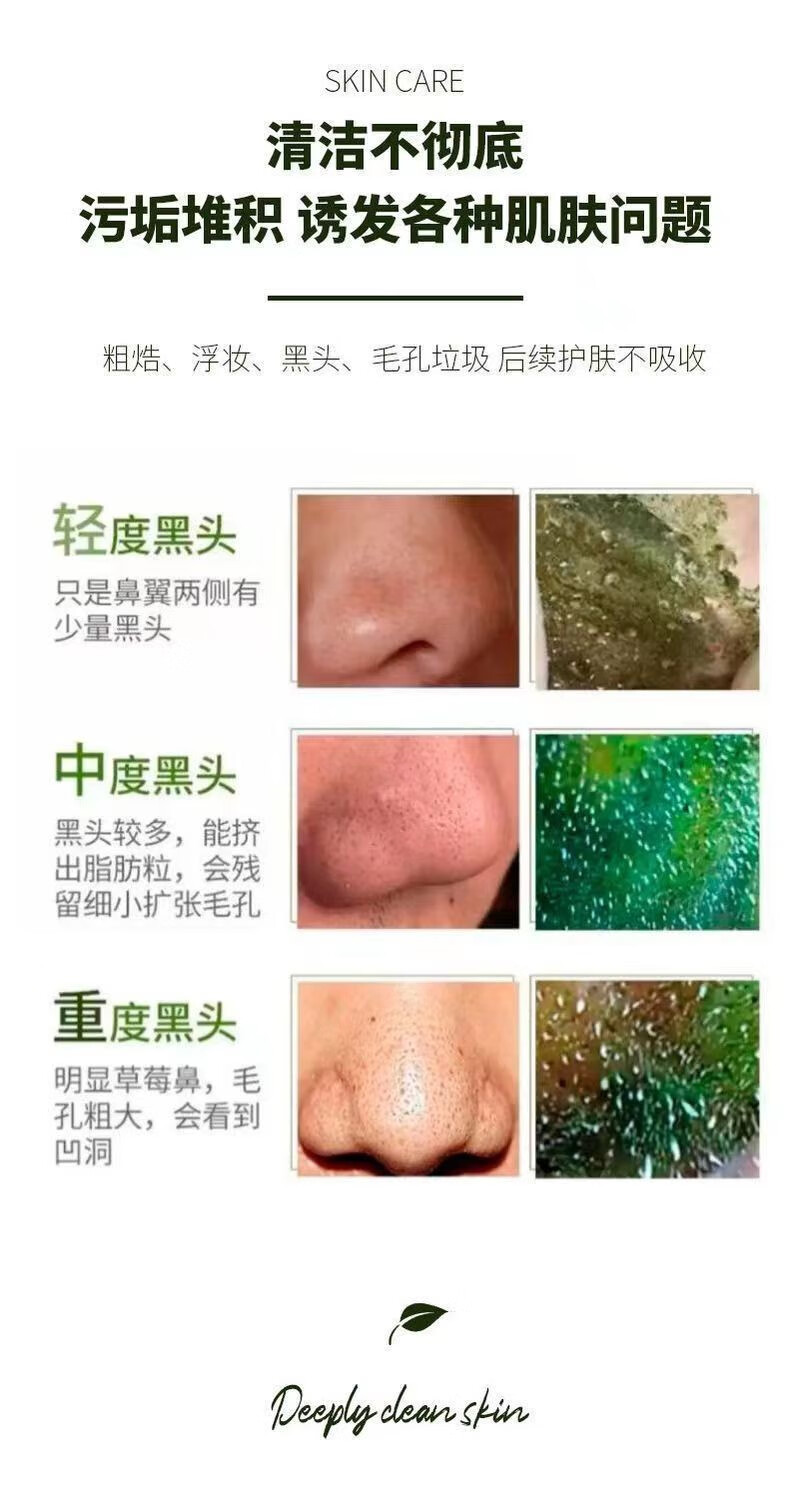 慕霖兮去黑头清洁绿茶面膜套装撕拉式鼻膜贴细致毛孔去粉刺深层清洁泥膜 绿茶面膜*一盒（赠送工具）