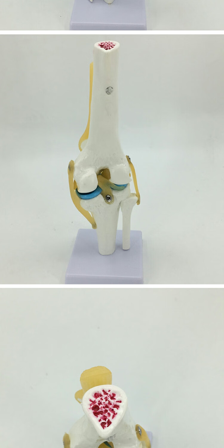 半月板交叉韧带活动膝盖骨髌骨 骨骼教学模型 膝关节模型