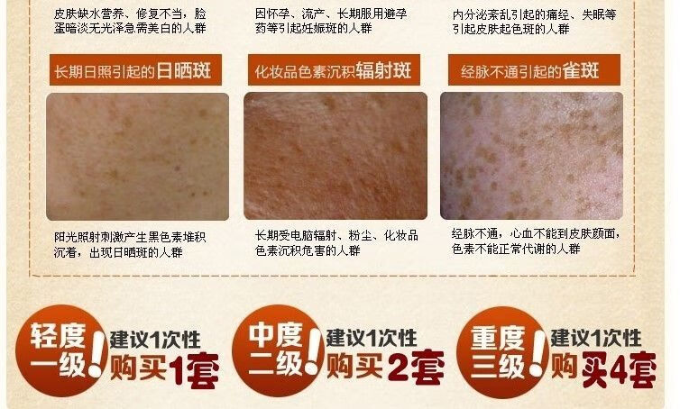 韩泊莉笑影冬虫夏草二合一美白祛斑霜套装淡斑保湿黄褐斑雀斑化妆品 日霜+日霜