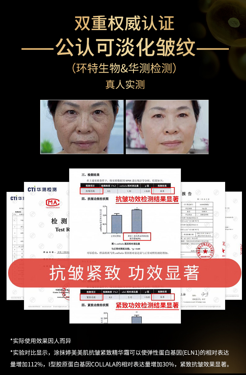 婷美美肌黑金抗皱紧致套装袪皱提拉紧致美白淡斑精华液面霜小金盒护肤品女 三盒少30+抗皱面膜5片