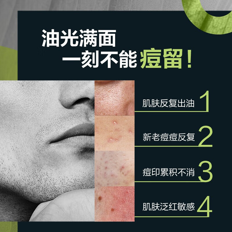 曼秀雷敦（Mentholatum）男士控油洁面抗痘去黑头角质 护肤品 洗面奶男洁面乳抗痘保湿 控油抗痘洁面乳150ml