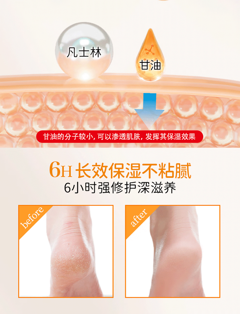 悠斯晶（yuskin） 日本原装进口护手霜维生素滋润保湿身体乳手足修护防干裂精华乳霜 【手足养护40g+120g组合】